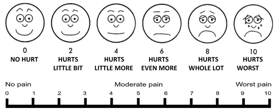 Wong-Baker FACES pain rating scale